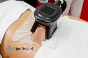 Are The Results From Aqualyx Permanent? 4 Compare Aqualyx Wales to other fat reduction treatments.