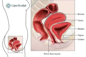Treatment For A Leaky Bladder 2 How EM Chair treatment Wales can help Leaky bladder issues. Read more now!