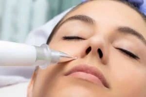Best Actinic Keratoses Removal 3 Actinic keratoses Wales solutions - book in today!